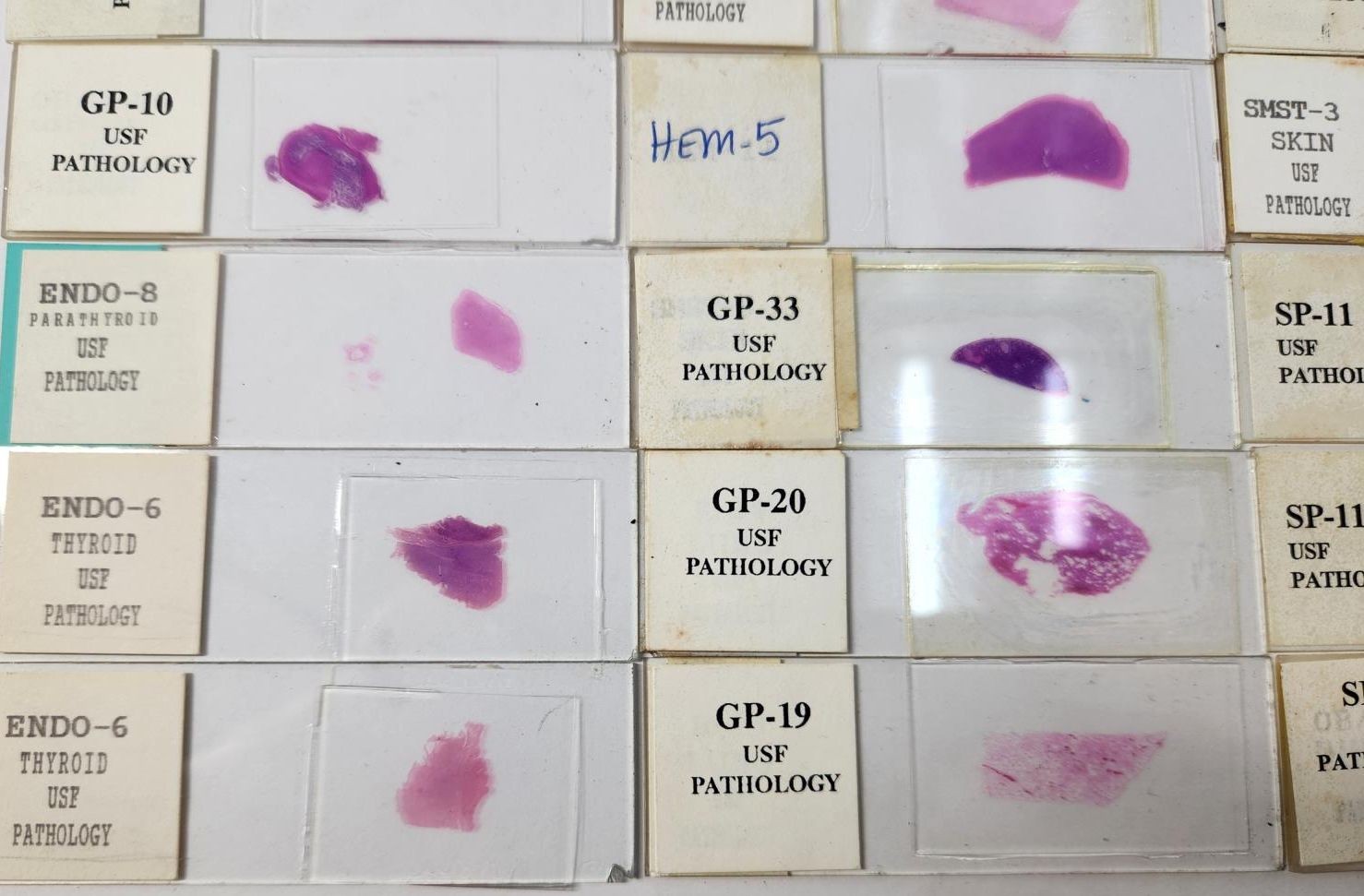 Lot Of 50 Vintage University Prepared Pathology Microscope Slides - Slides Only