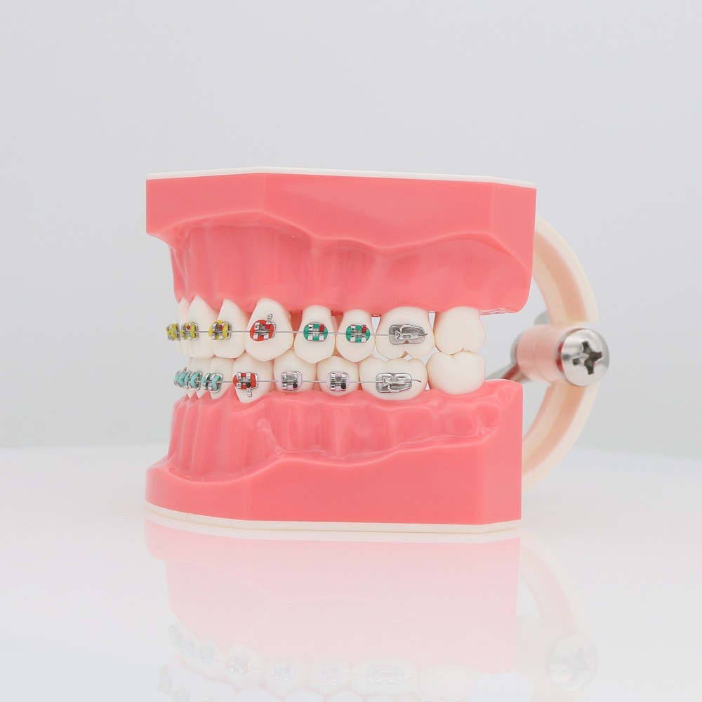Dental Orthodontic Teeth Model Typodonts Model Demonstration Model with Brackets