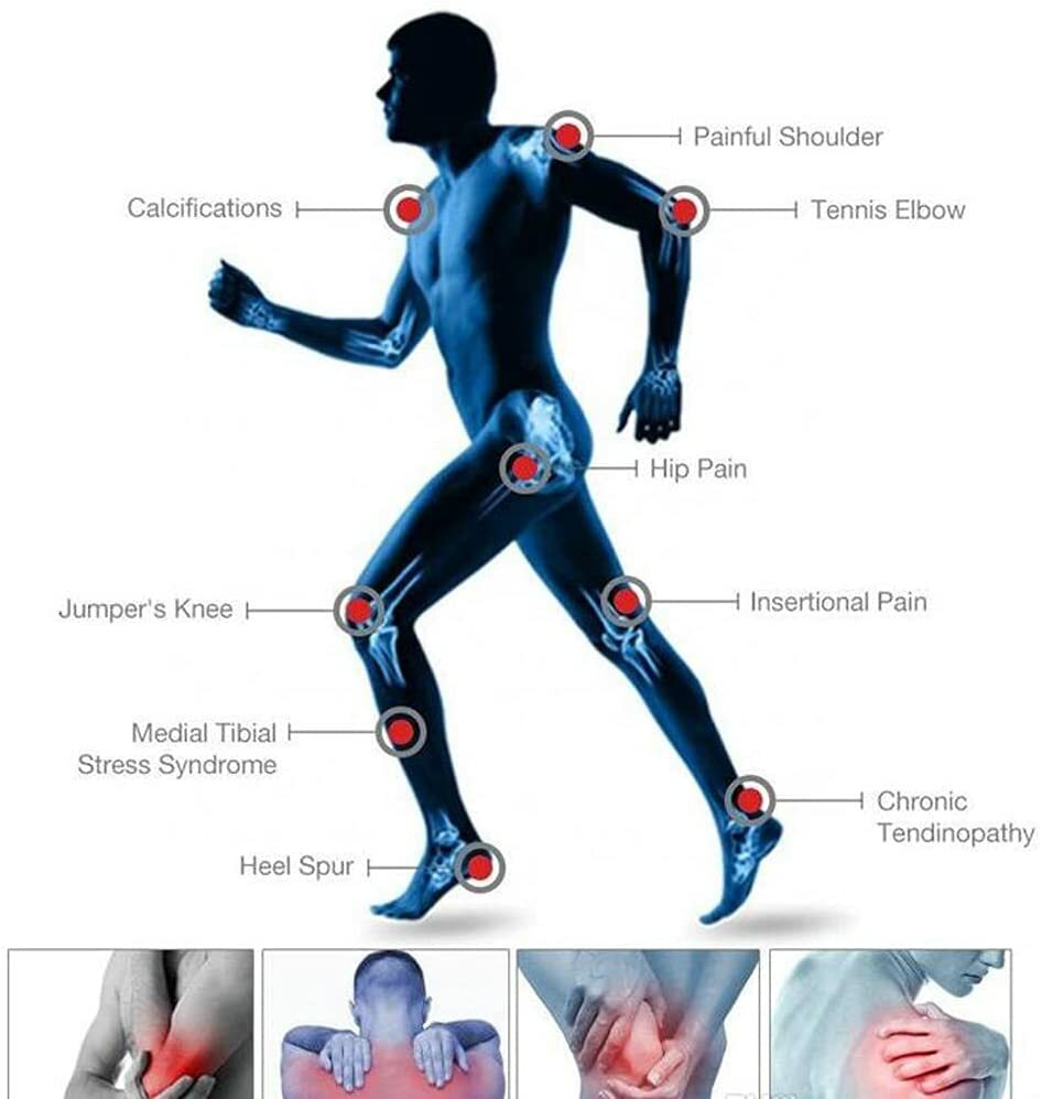 Touch Screen Focused Shockwave Therapy Machine for Pain Relief