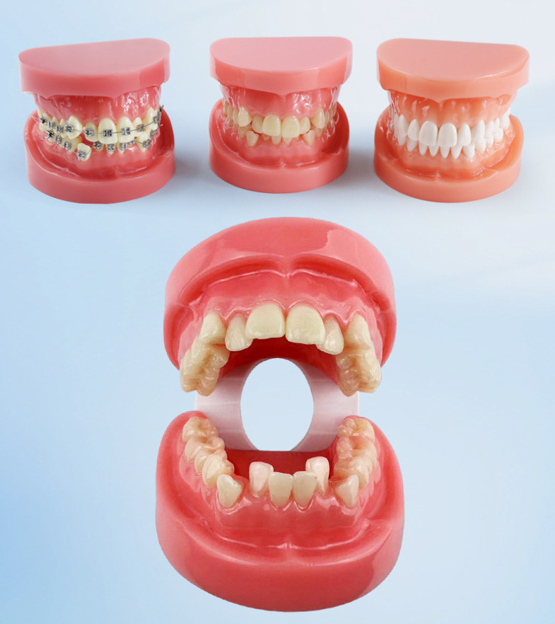 DENTAL TYPODONT MODEL Show Tooth Dislocation Orthodontic Restoration Display