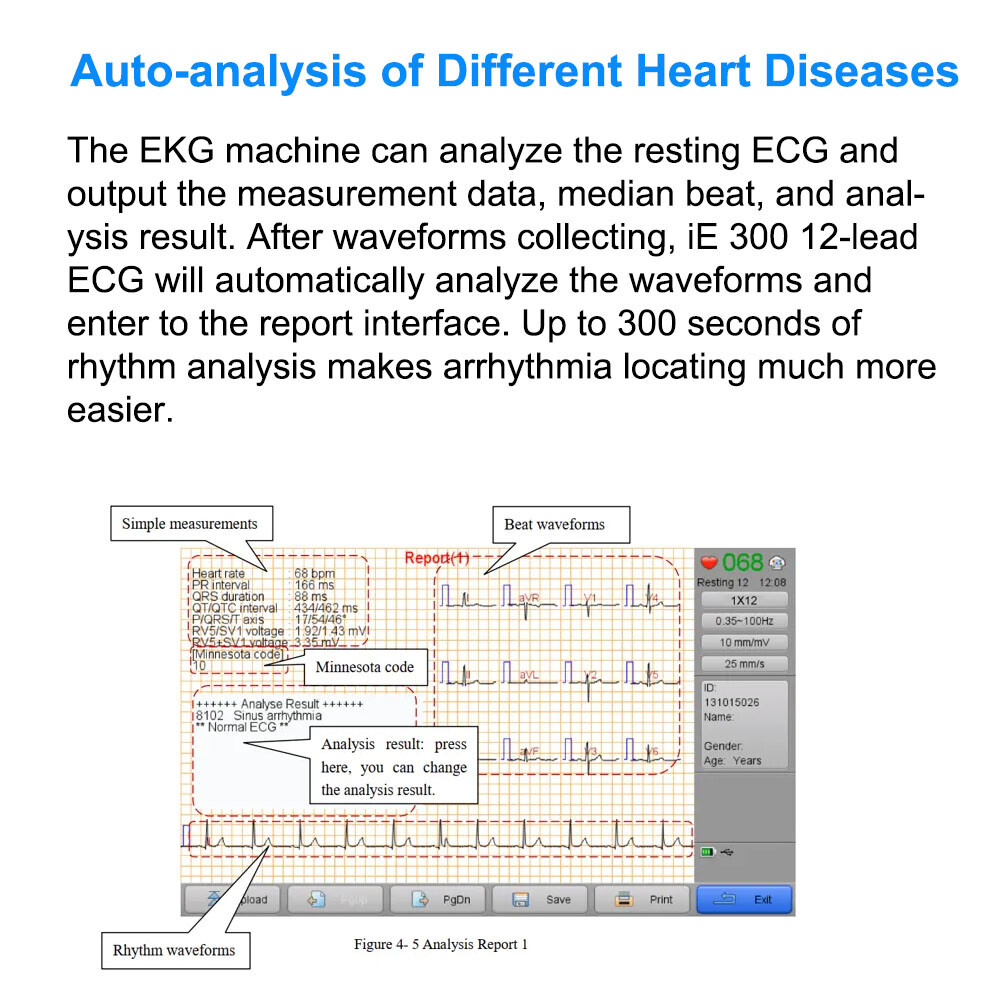 Biocare 12 lead ECG Machine Portable with Au-to Analysis Diagnosis ECG, Printer