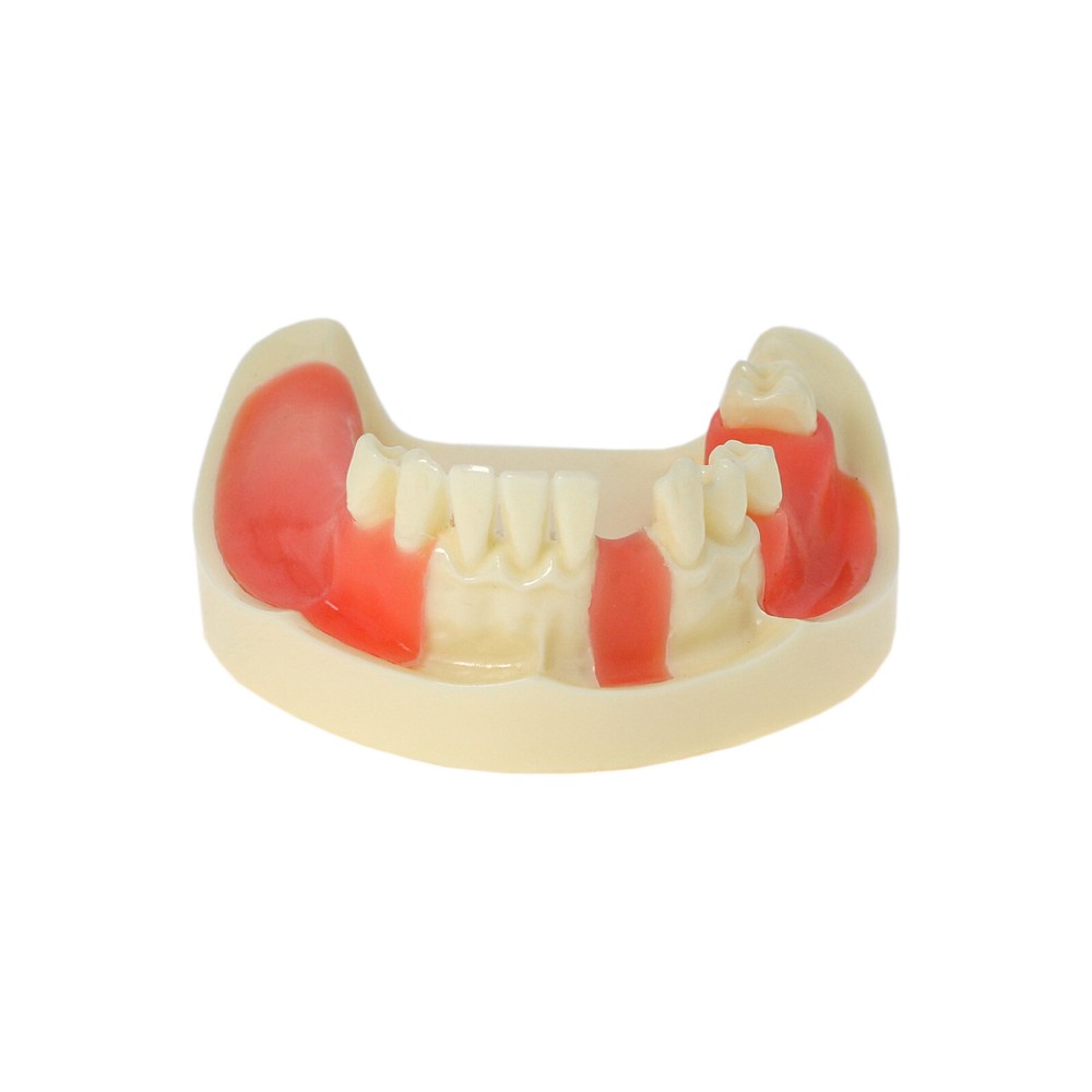 Multiple Types Dental Teeth Model Typodont Ortho Implant Practice Demo Teaching