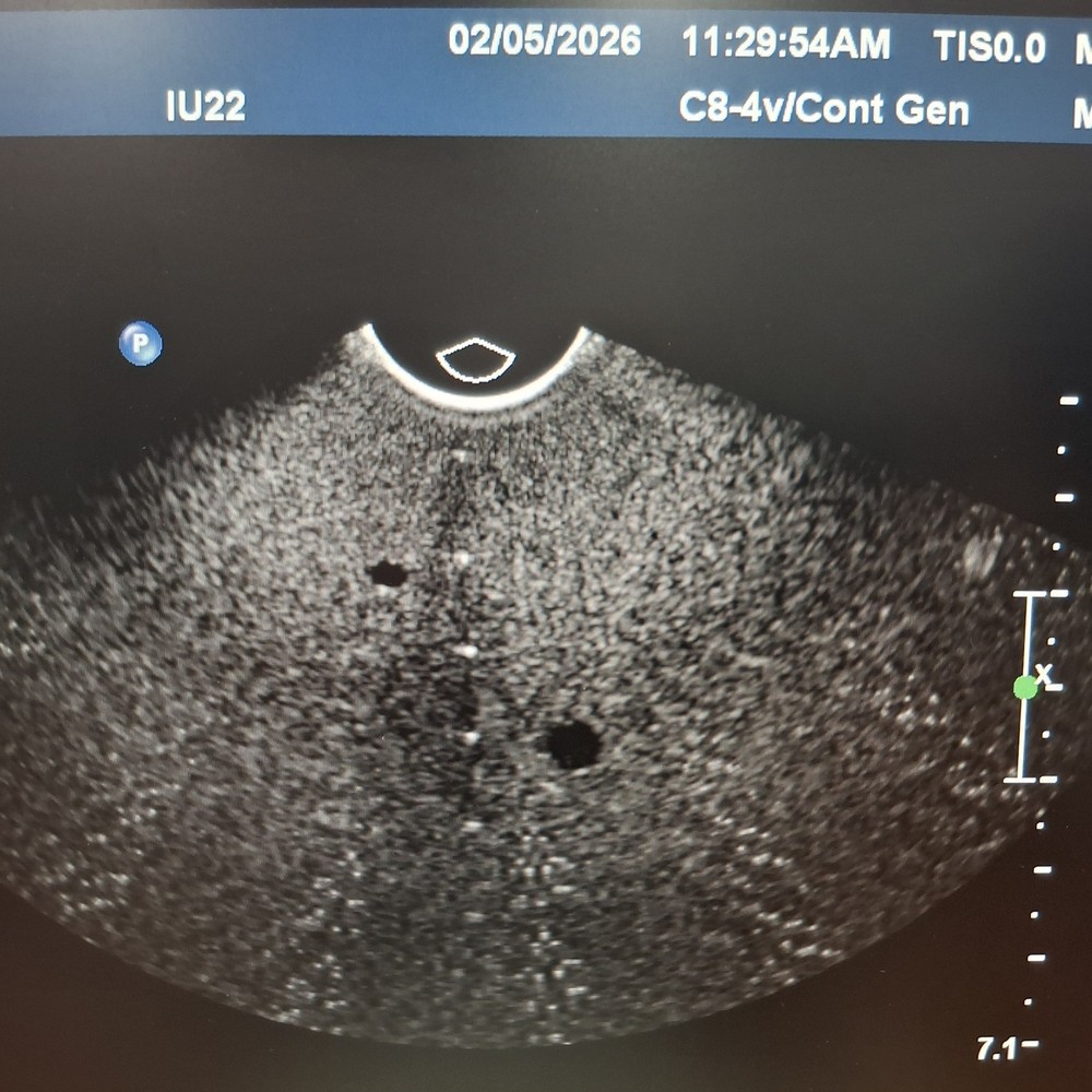 Philips C8-4V Curved Array Transducer