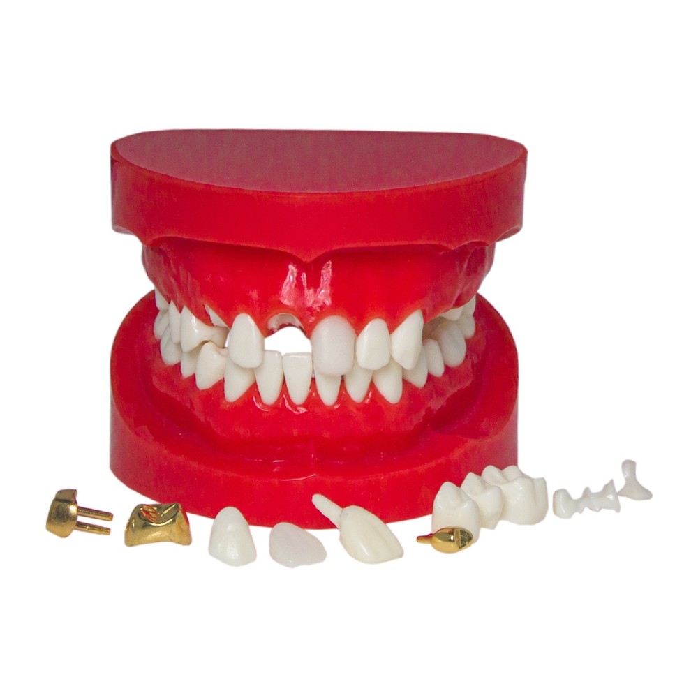 Dental M6004 Teaching Typodont Restoration Teeth Model Crown Post Core Bridge
