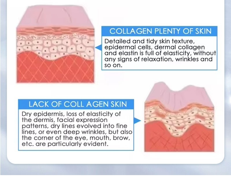 360° Fat Removal Machine