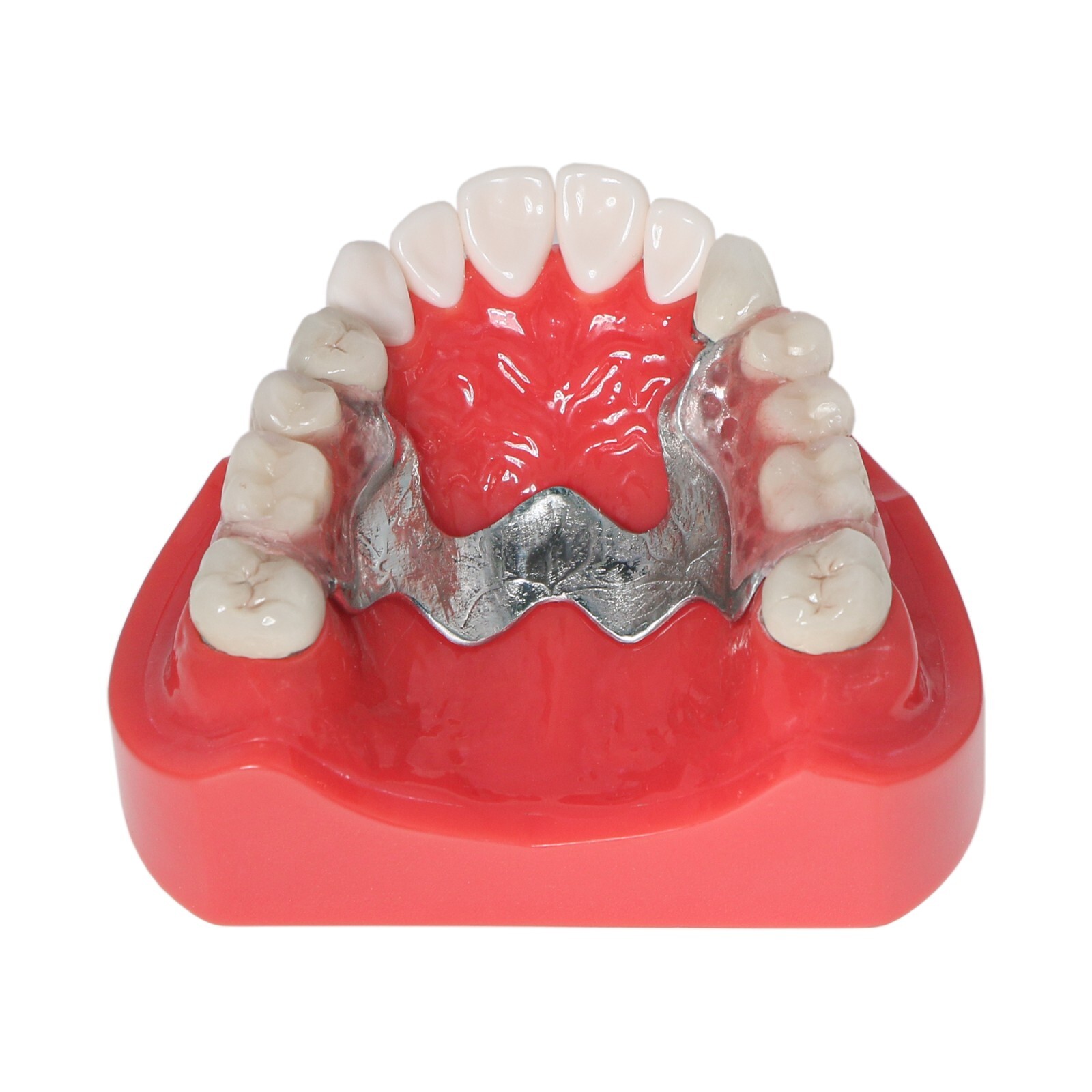 Dental Implant Typodont Teeth Restoration Model Series Overdenture Practice Demo