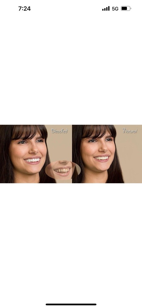 Imako Premium Cosmetic Teeth - 2 Pack - Large, Bleached White - Upper Veneers