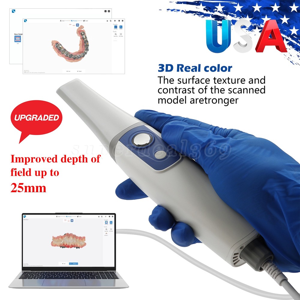 Dental Intraoral Scanner