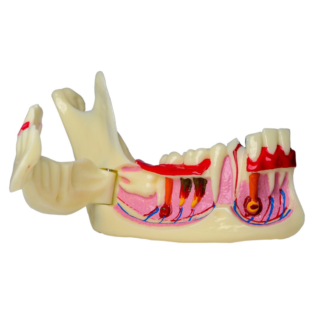 Multiple Types Dental Teeth Model Typodont Ortho Implant Practice Demo Teaching