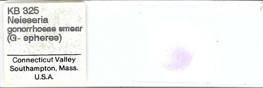Neisseria gonorrhoeae Smear Microscope Slide