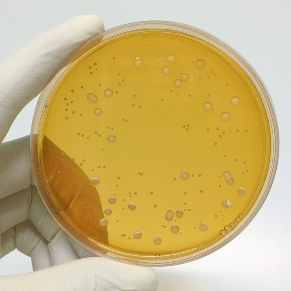 10 Pcs Prepoured Petri Dish Nutrient Agar Plate Extract