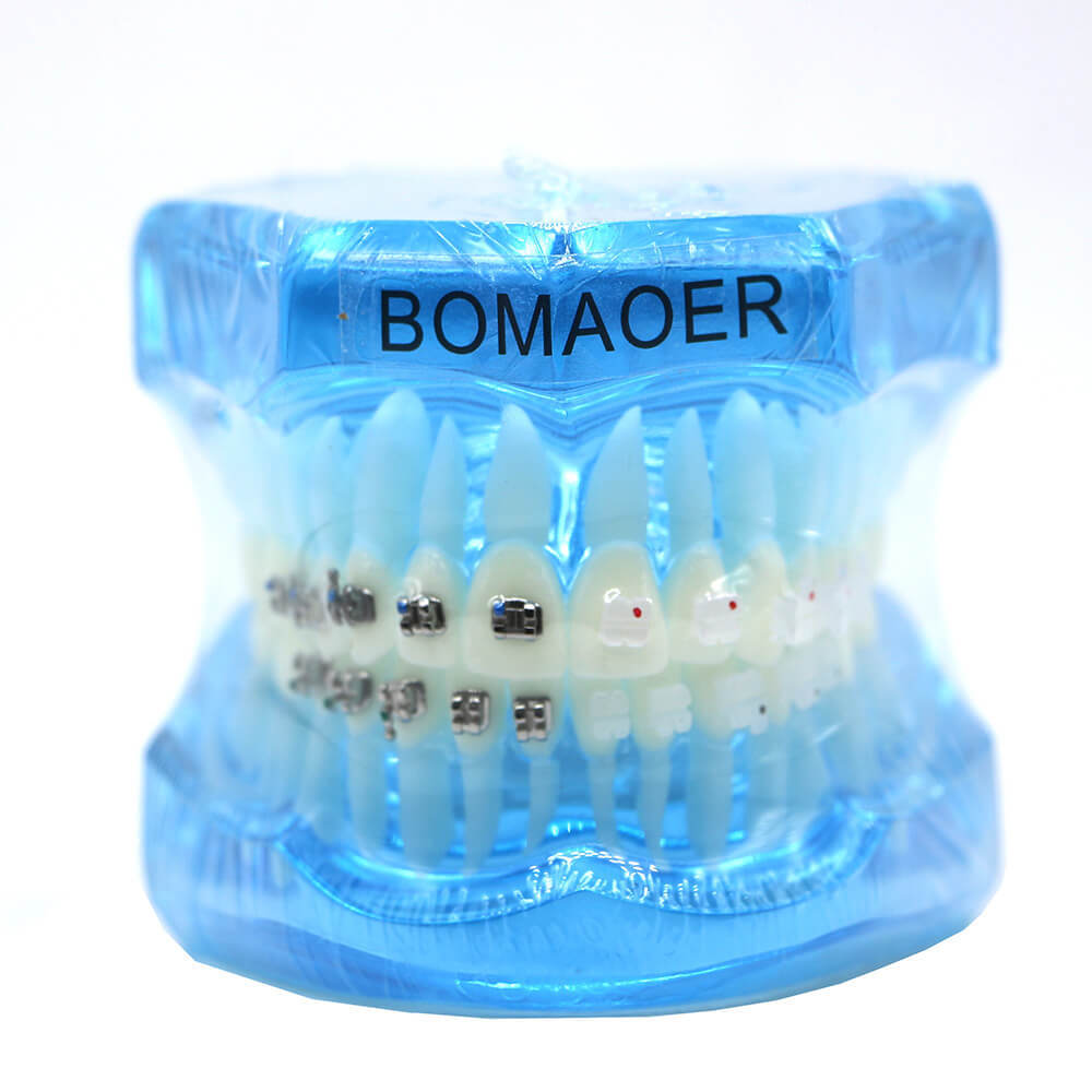 Dental orthodontic contrust teach study teeth model mental and ceramic bracket
