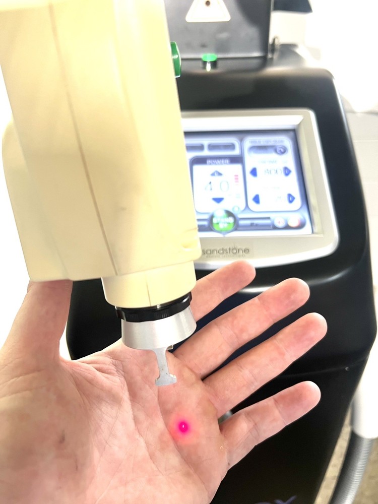 Sandstone Cortex Laser Co2 AND Erbium