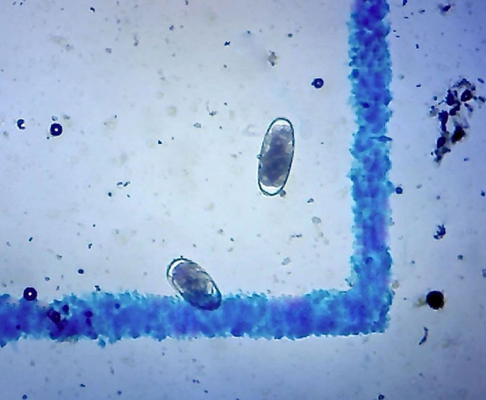 Fecal Egg Count Supply - McMaster Method, by . Fecal/Worm Egg Count for Paras...