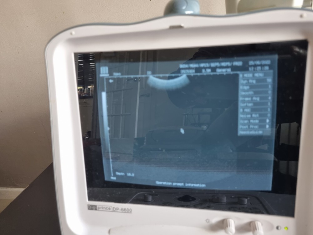Mindray Digi-prince DP-6600 Portable Ultrasound Unit
