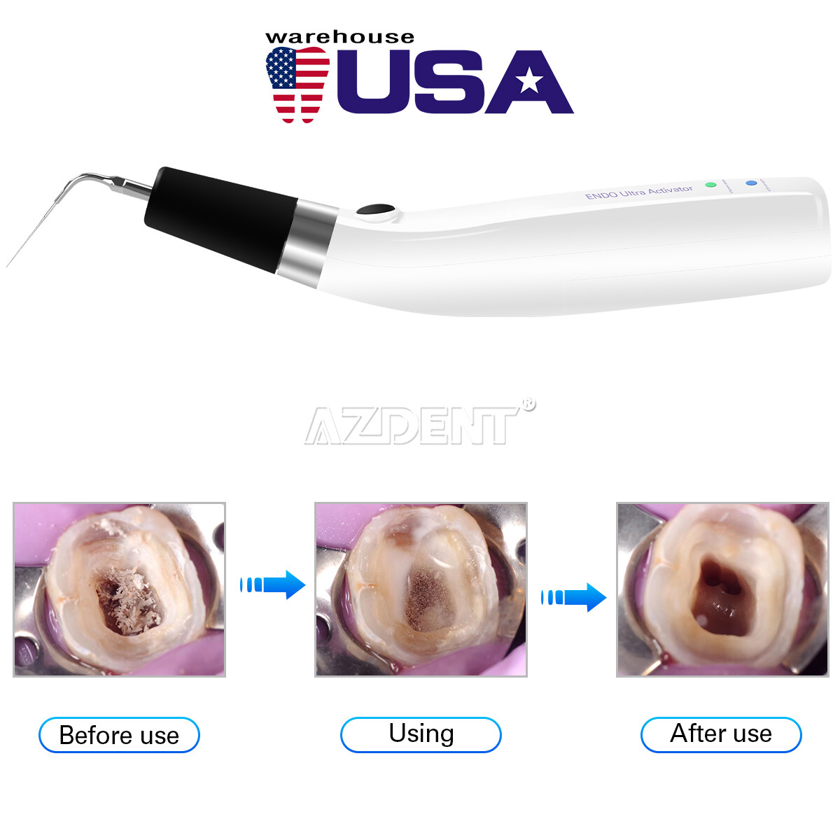 Dental Endo Ultra Activator Ultrasonic Irrigator Root Canal Handpiece 6 Tips