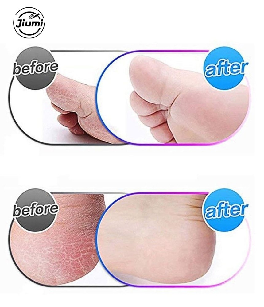 8 Pack Extra Coarse Replacement Rollers for Amope Pedi Refills Electronic