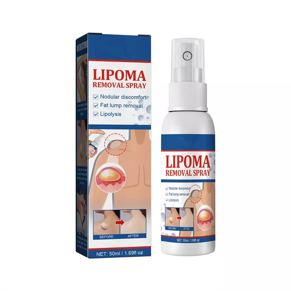 50ML Lipomheilung Reduction Spray, Instant LumpFree Lipoma Removal Spray