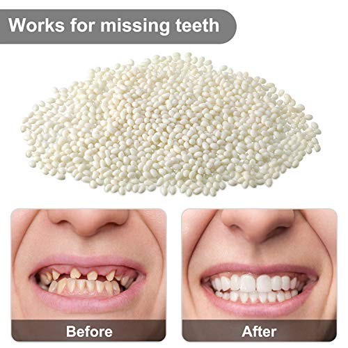 100G Bead Teeth Tooth Solid Gel Replacement Moldable Thermal Fitting Bead Teeth