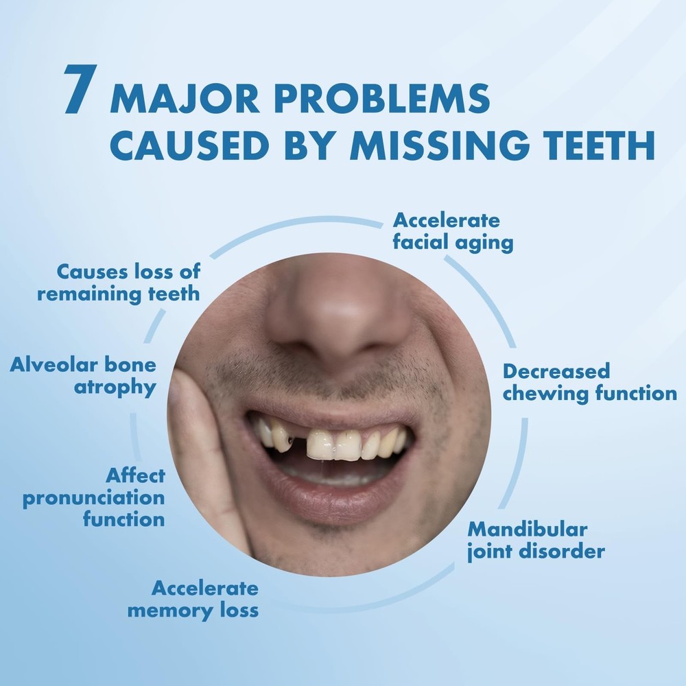 Custom Removable Dentures – Personalized Partial Denture Set for Tooth Rep