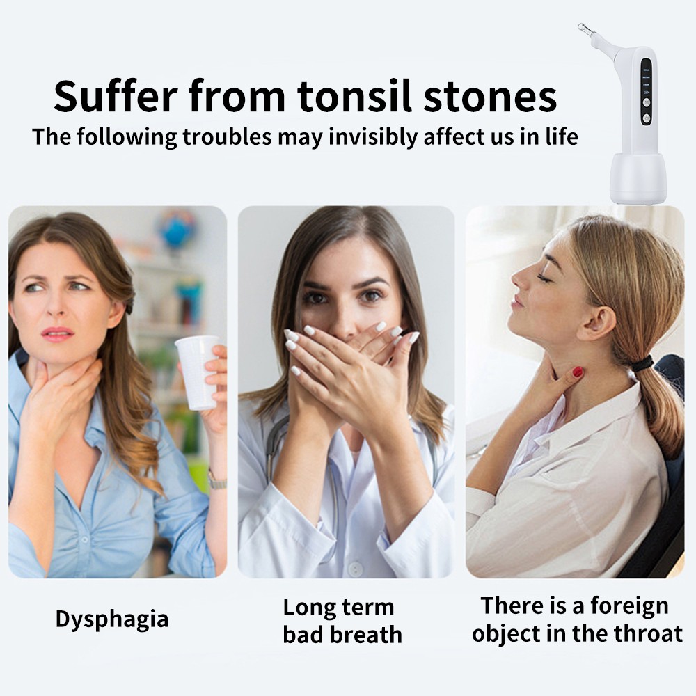 Electronic Vacuum Tonsil Stone Remover Kit LED Light 3 Mode Tonsil Stone Cleaner