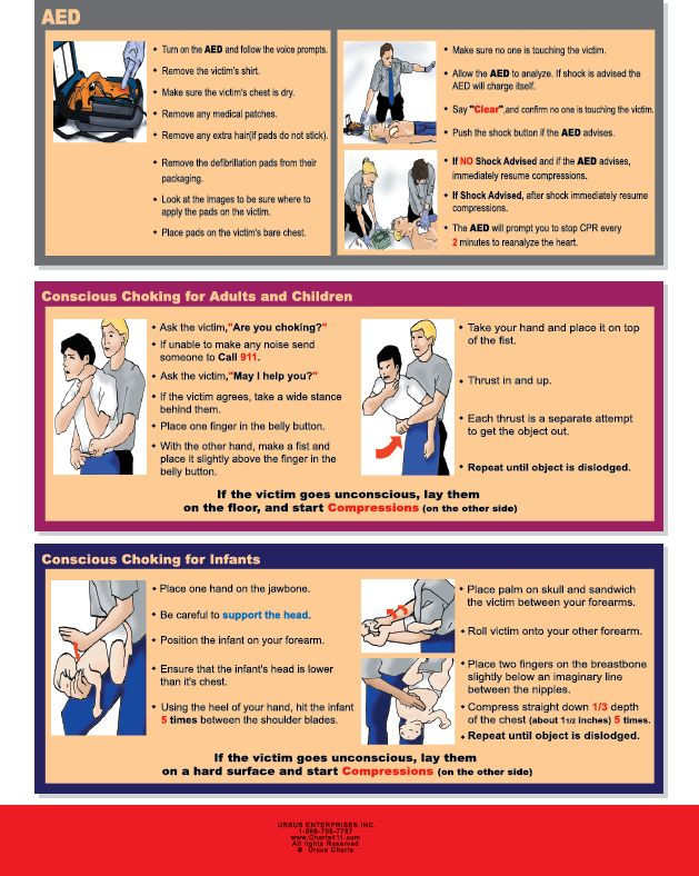 Hands Only CPR / Choking Reference Chart for Non-Trained Persons-2015 Guidelines