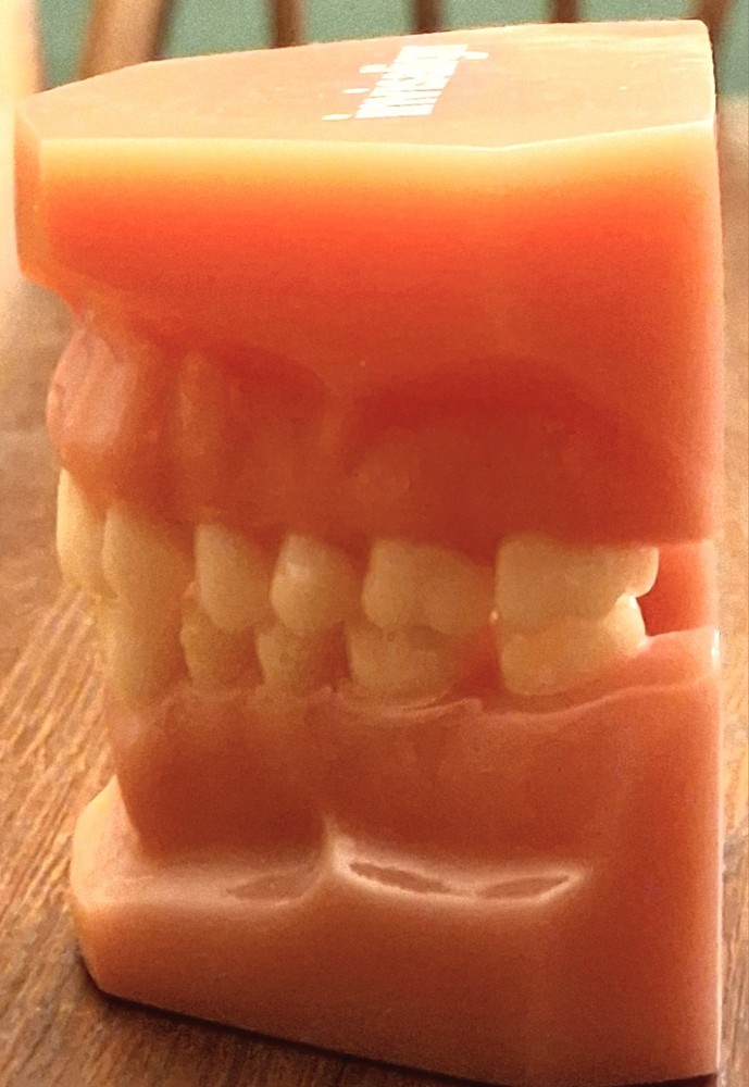 Invisalign Typodont