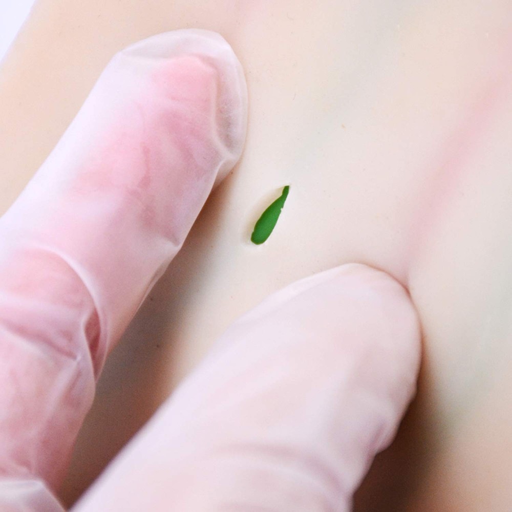 Realistic IV Injection Training Pad with 4 Embedded Veins & Blood Return Feature