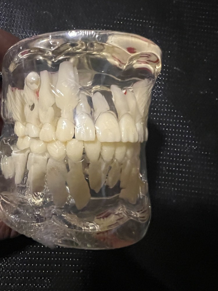 Dental Pathology Demonstration Study Tooth Teeth Model