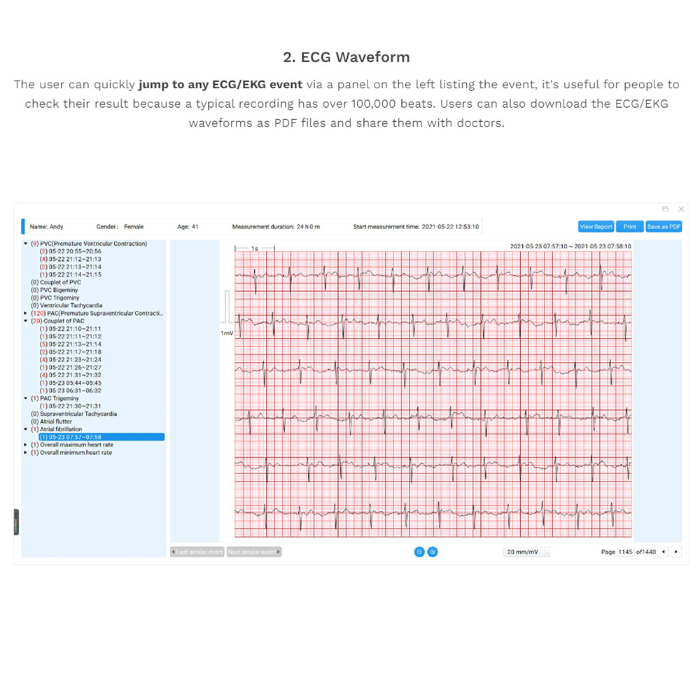 24 hours ECG/EKG Holter Monitor System with AI analysis Detects Afib PC Software