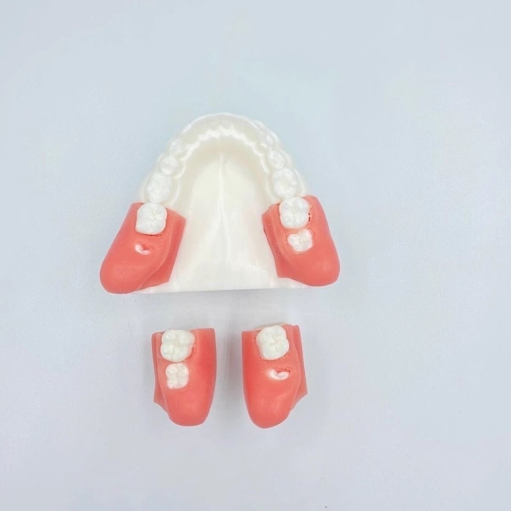 Dental Impacted Tooth Extraction Practice Model Dental Training Display