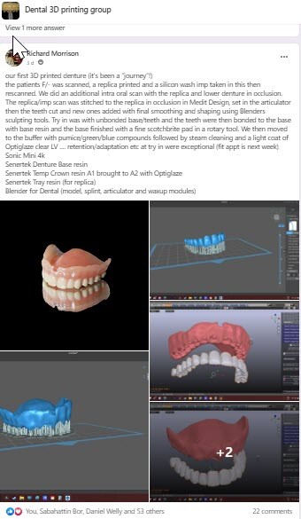 DLP SLA LCD 3d printer denture base resin for manufacturing dentures