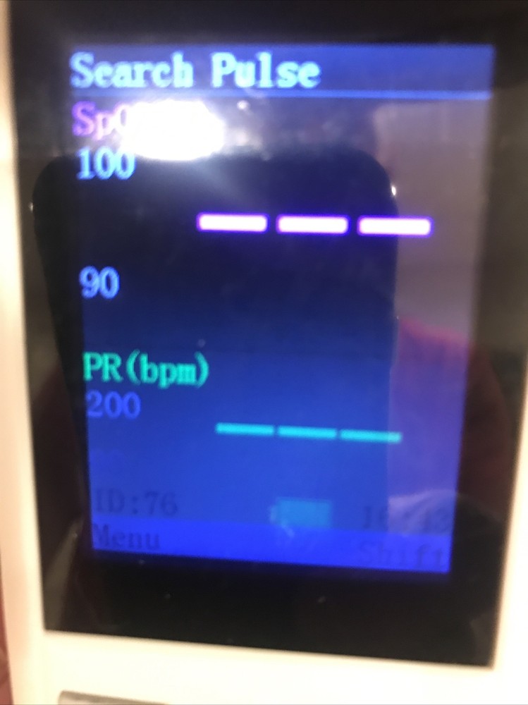 ACCUWAVE PORTABLE PULSE OXIMETER