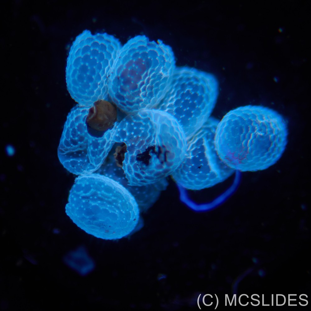 Vintage microscope slide: fluorescence moth eggs for reflected light