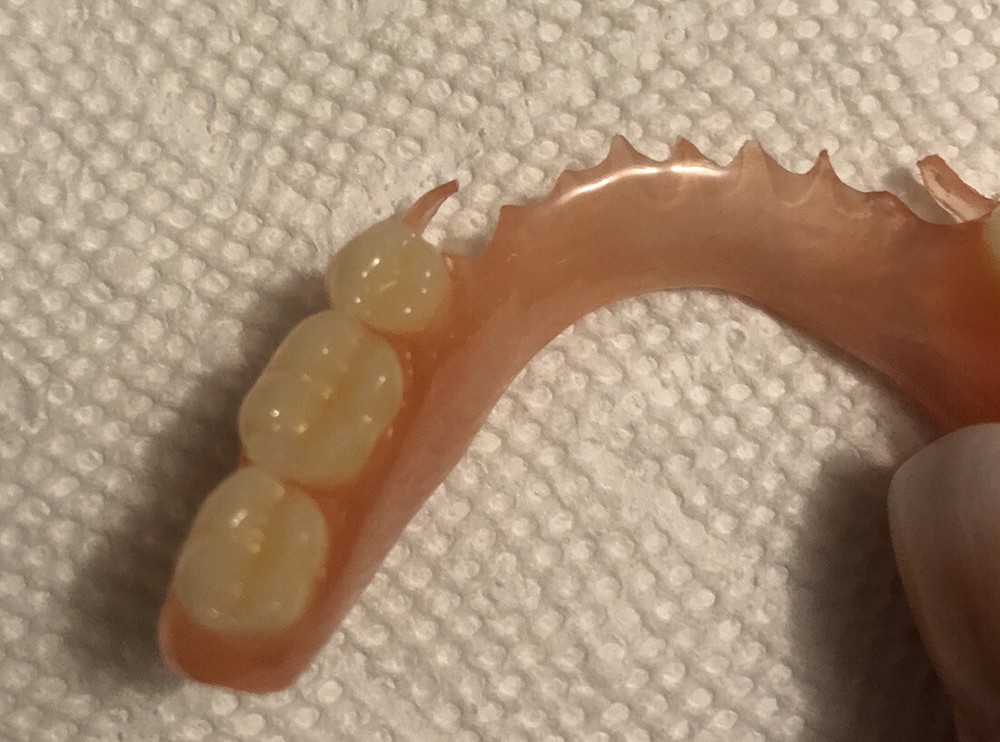 BURBANK Replacement DentalLab Partials Lower Side 6 teeth CustomMadeMissingTooth