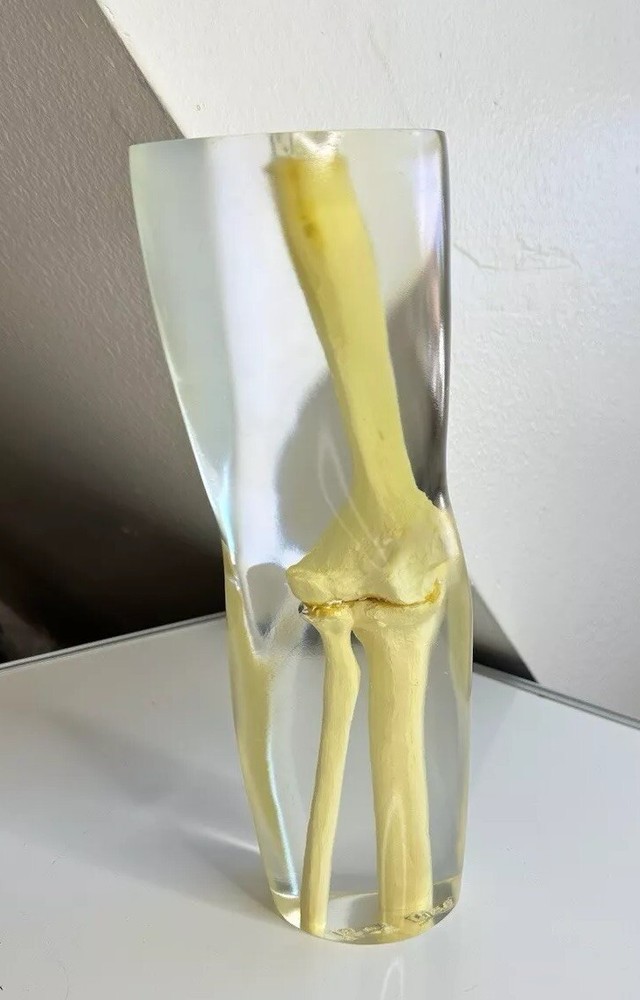 RSD Phantoms Natural Transparent Mannequin Elbow (Testing & Calibration)