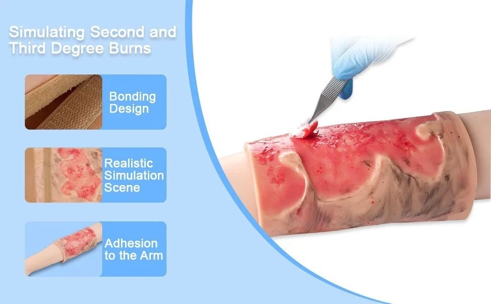 Limbs Burn Training Model, Realistic Wound Simulation Module Simulated Skin