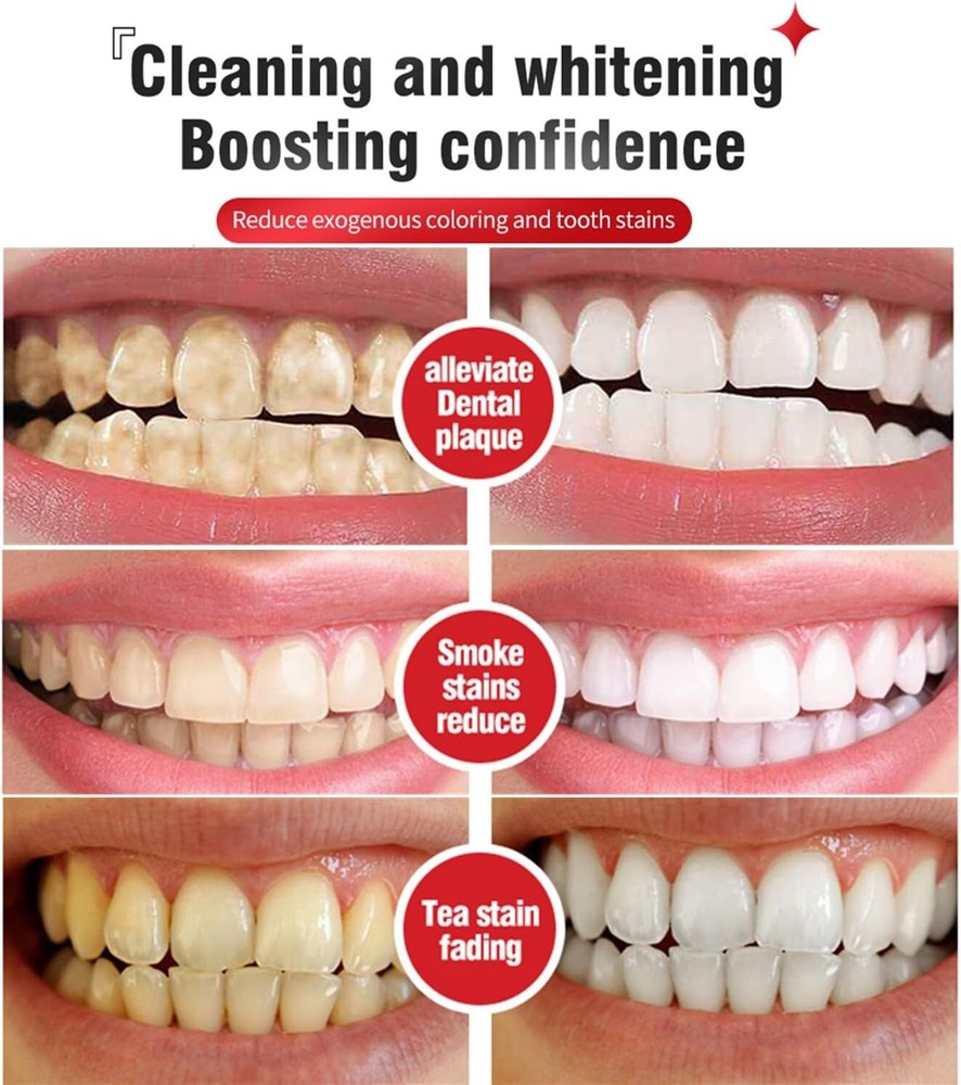 4Pcs Super Probiotic SP-6 Toothpaste, Probiotics Bright White Toothpaste, Sp 6