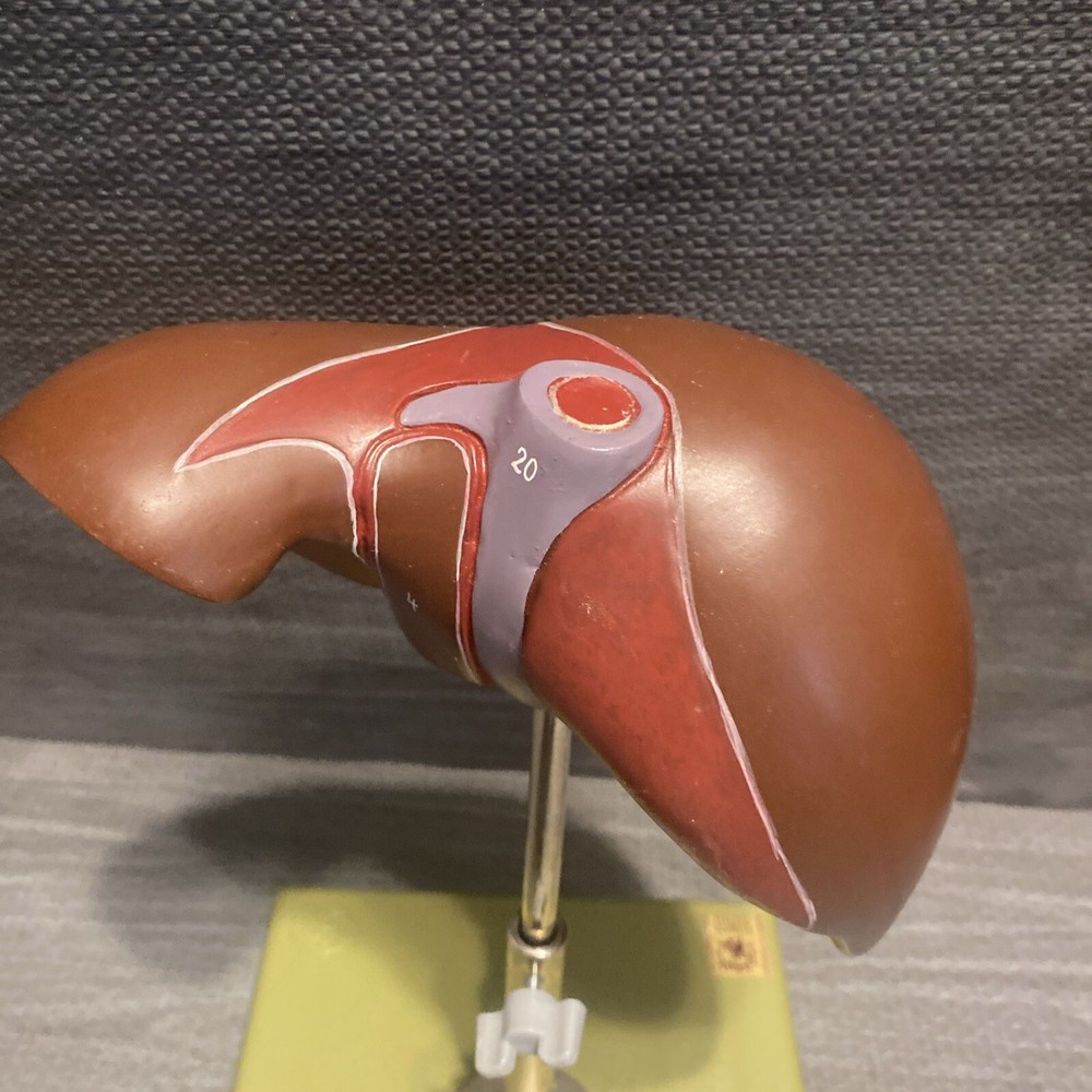 Somso Liver On Adjustable Stand Model - Numbered - Damaged
