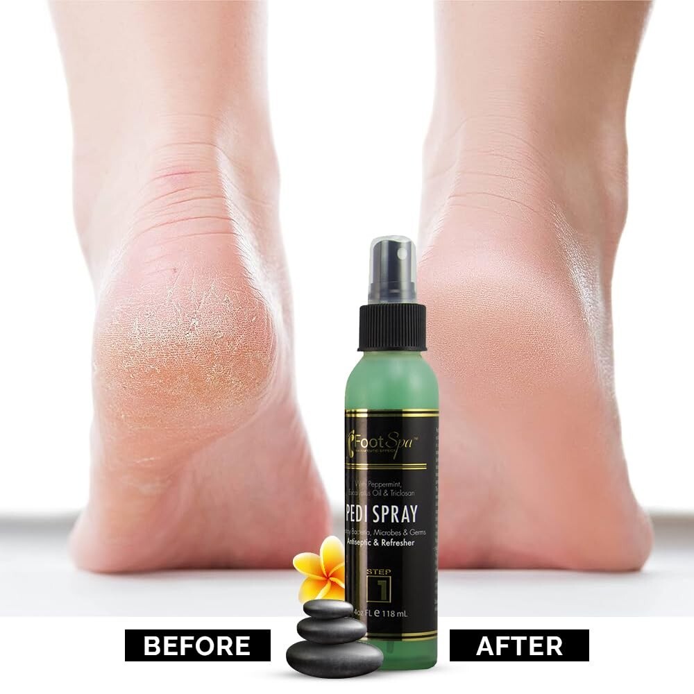 Foot Spa Pedi Spray Antiseptic, Mint & Eucalyptus 4oz