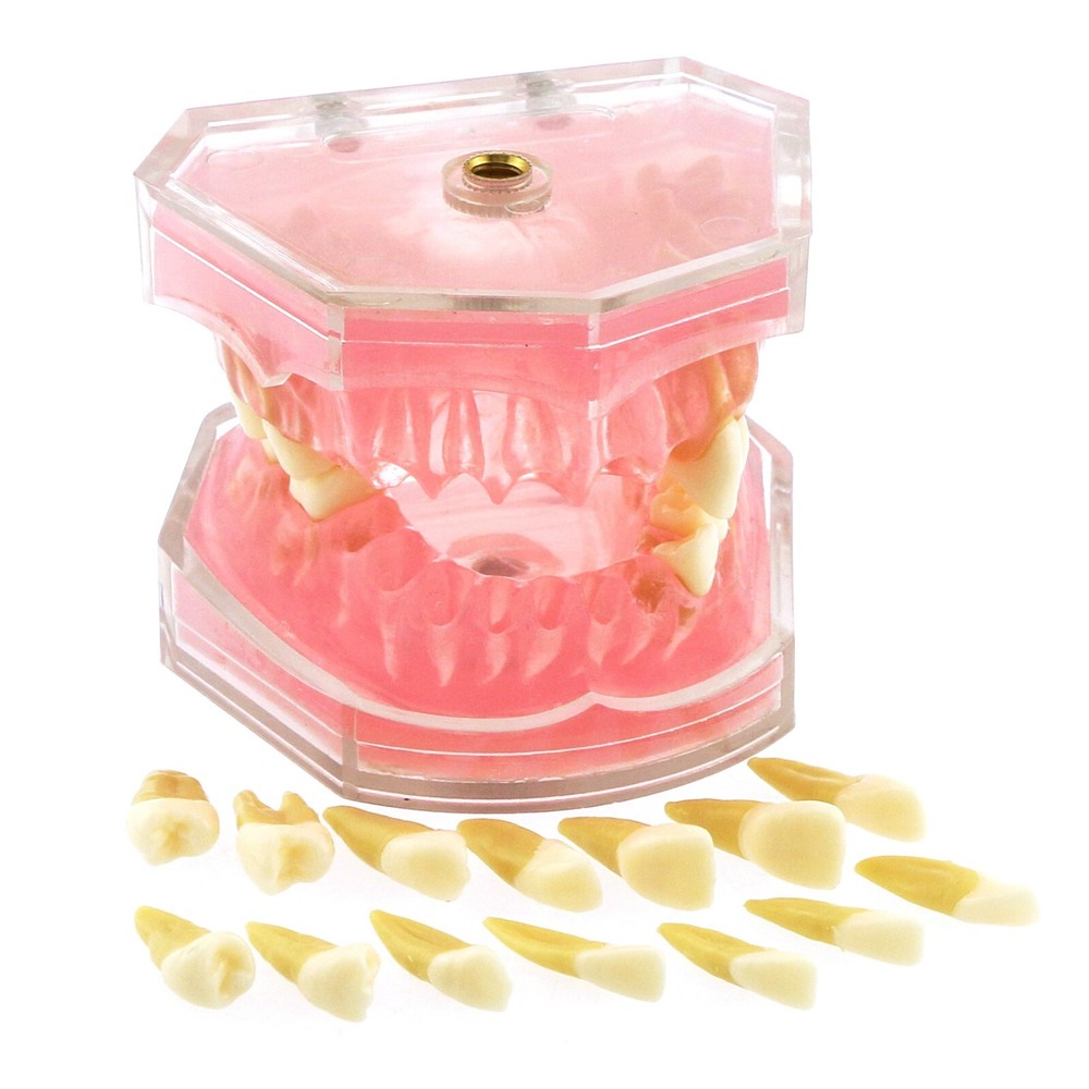 Dental Typodont Standard Teeth Model Soft Gum Simulation Cheek 28Pcs Removable
