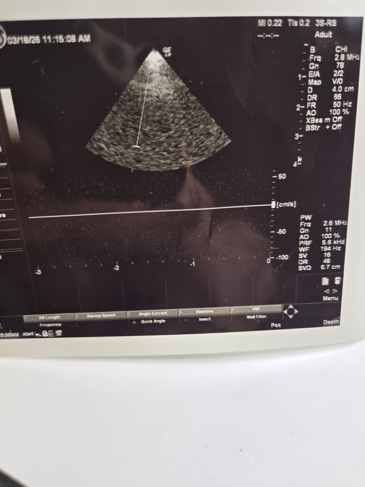 GE 3S-RS Probe for Logiq E Portable Ultrasound