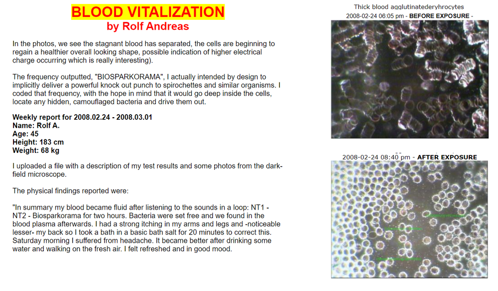 Frequencies support Hulda Clark Zapper “Frequency Generator” Virus Killer