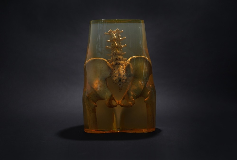 3M Xray Calibration Phantom Pelvis C.1960's