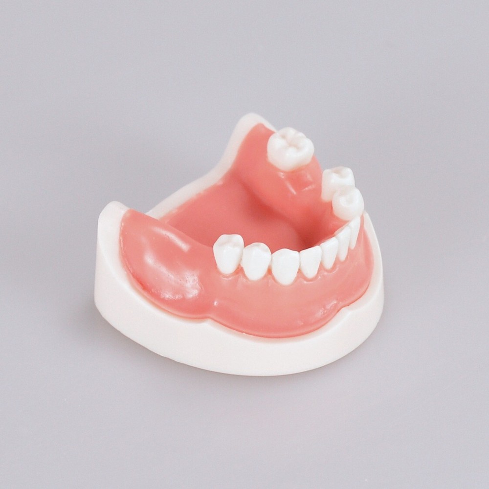 Dental Teeth Missing Implanting Typodont Training Dentistry Model Display