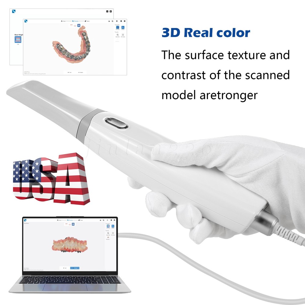 Digital Impression Intraoral Scanner Open Data Prosthetics Implants Orthodontics