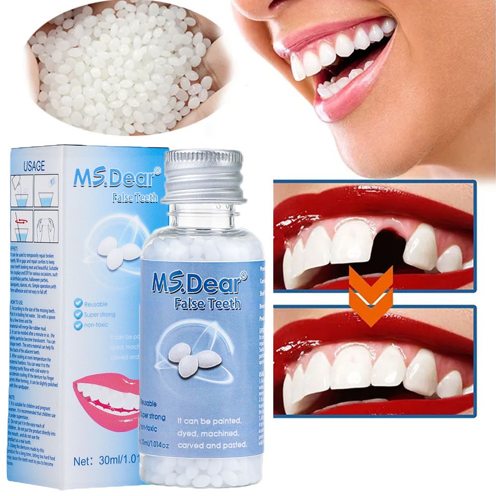 Tooth Repair Kit - Temporary Teeth Replacement Kit for Missing & Broken Teeth US