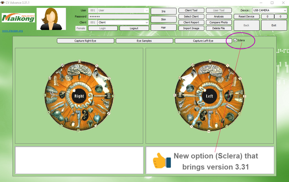 Analyzer Camera HD Iriscope Eye Camera with Analysis Software for Detailed Eye