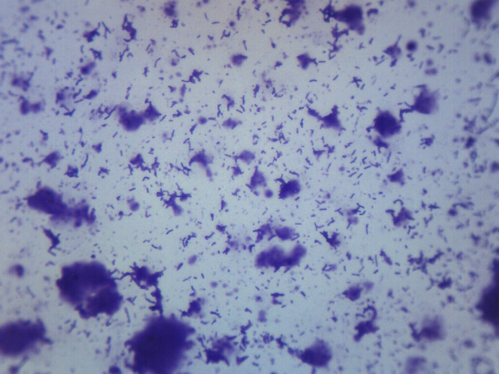 Human Mouth Bacteria, WM - Prepared Microscope Slide - 75x25mm - Eisco Labs