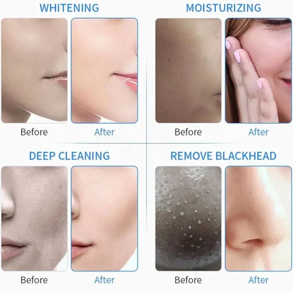 High Pressure Non-Invasive Water Light Microcrystalline Introduction Machine